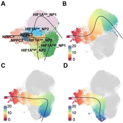 Investigating the characteristics of mild intervertebral disc degeneration at various age stages using single-cell genomics